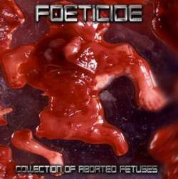 Foeticide (SVK) : Collection of Aborted Fetuses